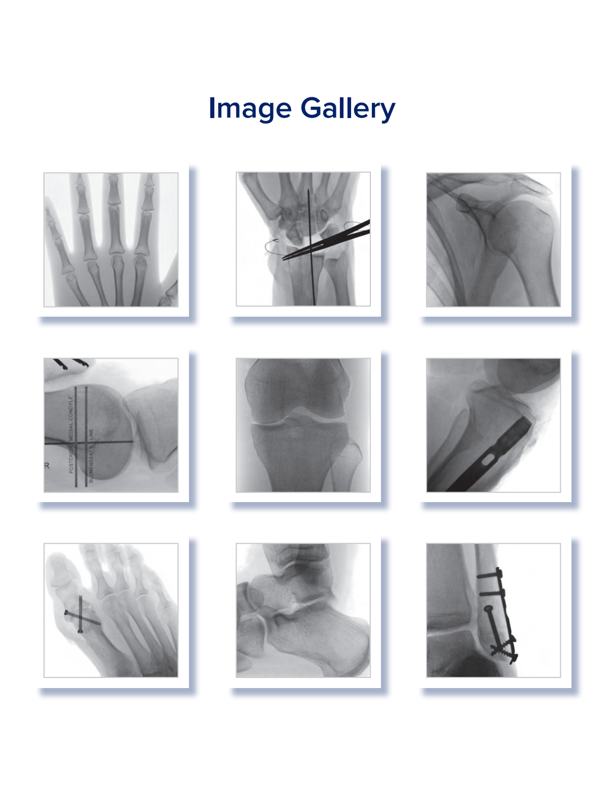 Hologic Miniview Hologic Fluoroscan InSight FD Mini C-Arm System – Medical Equipment Doctor
